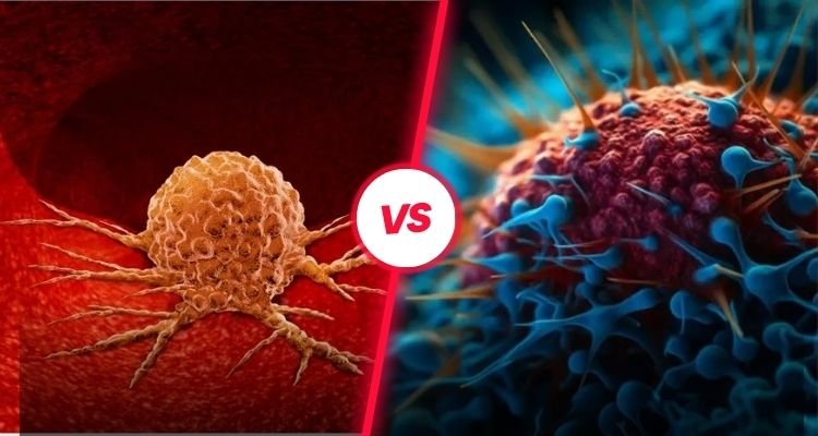 What is the Difference Between a Benign Tumor and a Malignant Tumor?