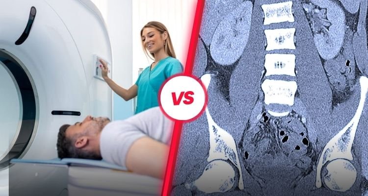 What is the Difference Between a Low-Dose CT Scan and a Regular CT Scan?